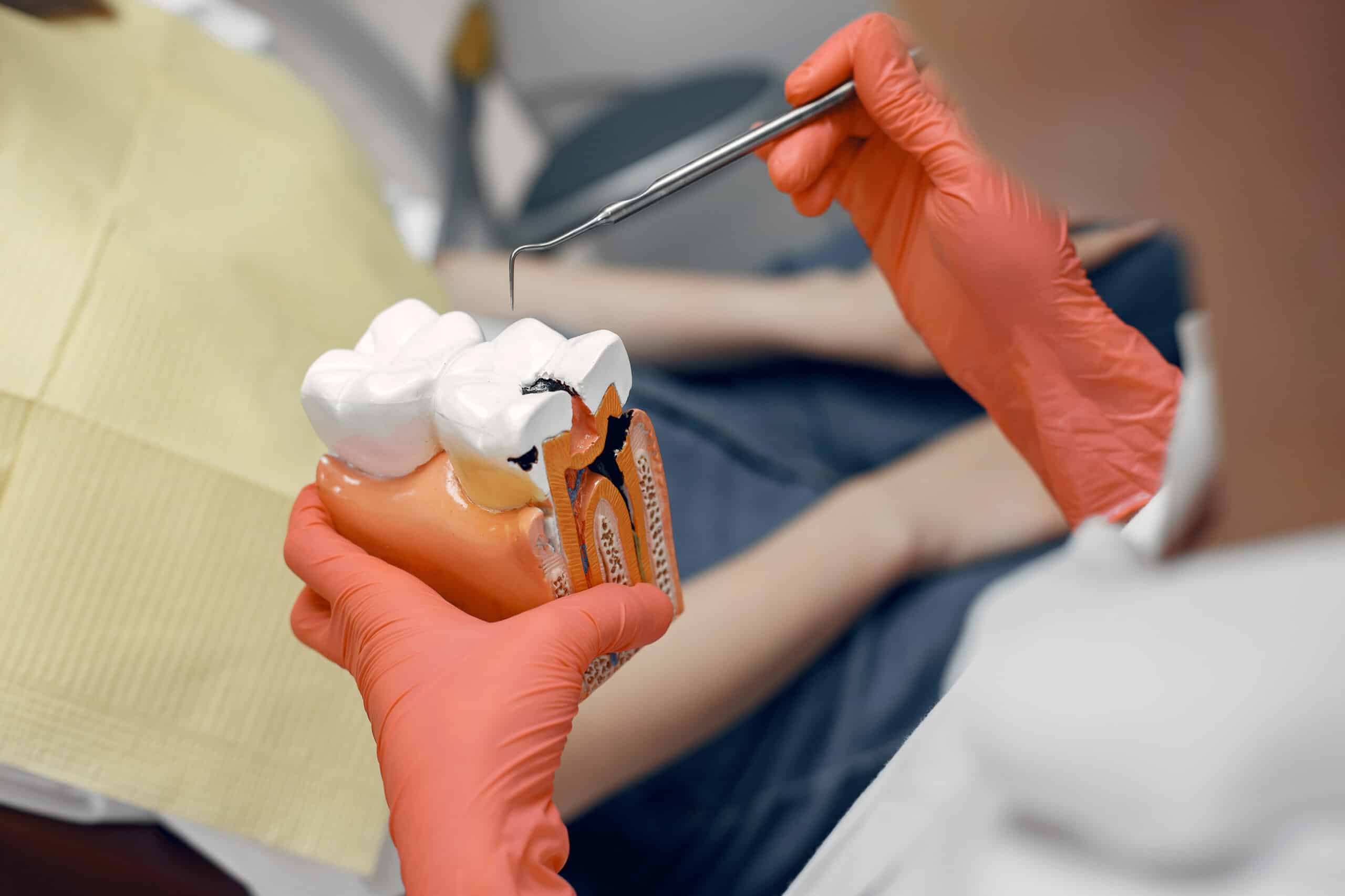 Root Canal Therapy in El Segundo, CA