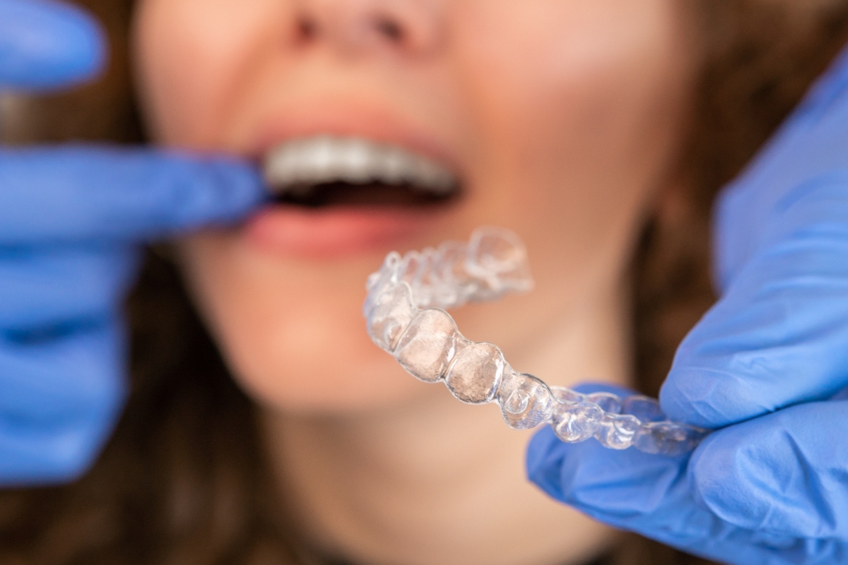 Invisalign dentist Culver City