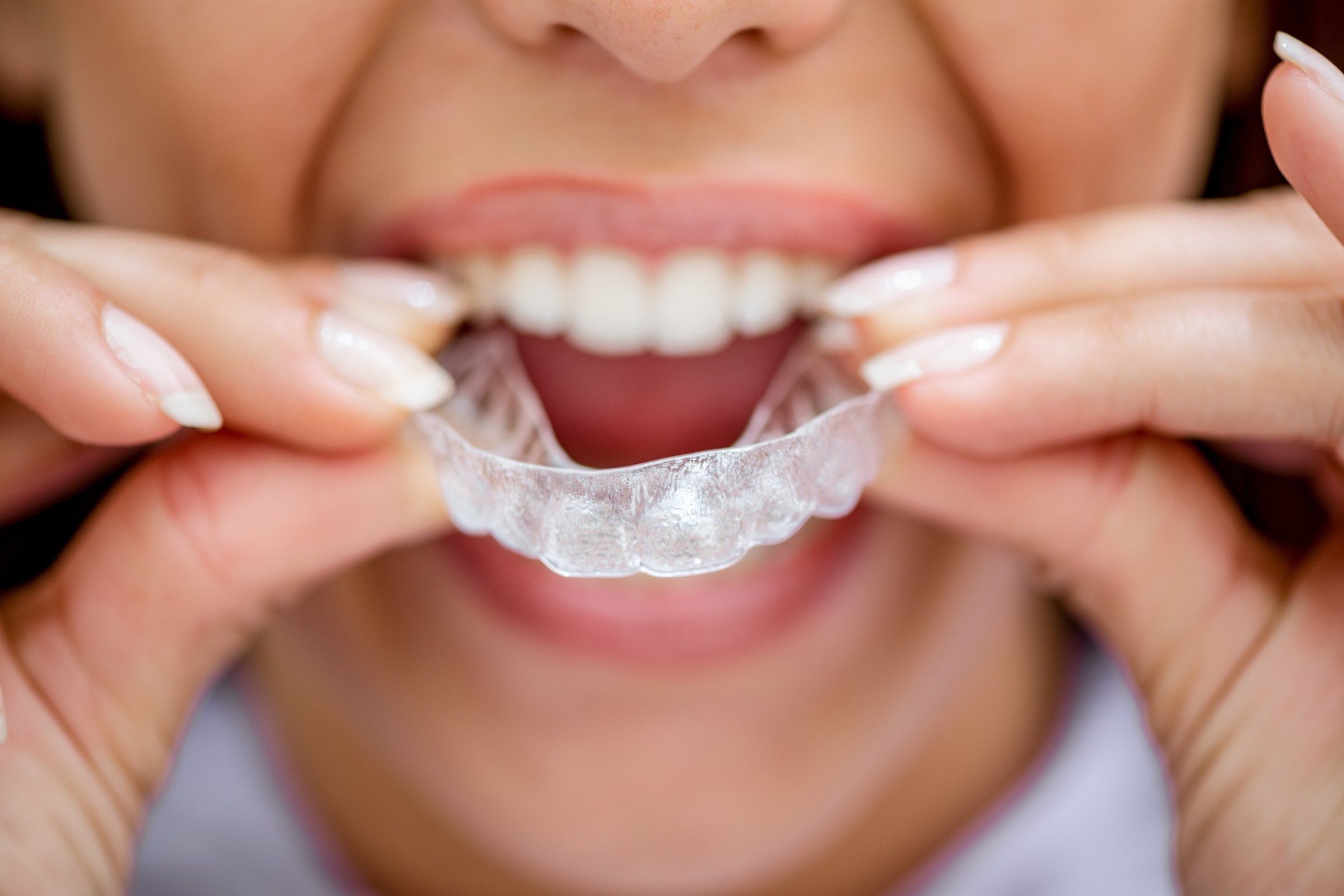 Invisalign Dentist El Segundo