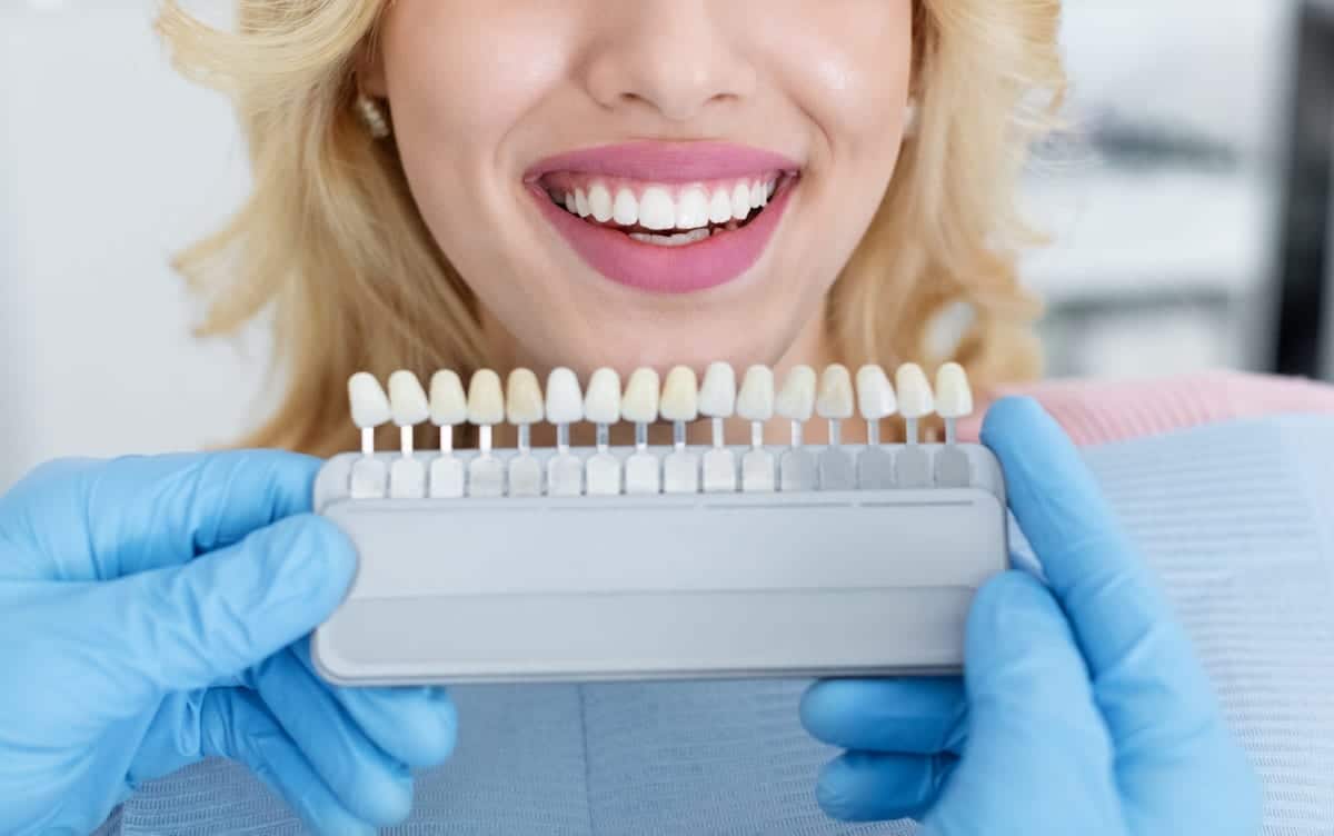 Veneers in Hawthorne