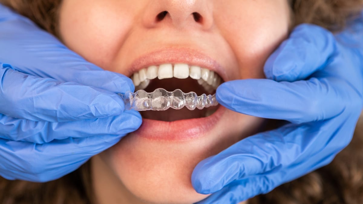 Invisalign in El Segundo